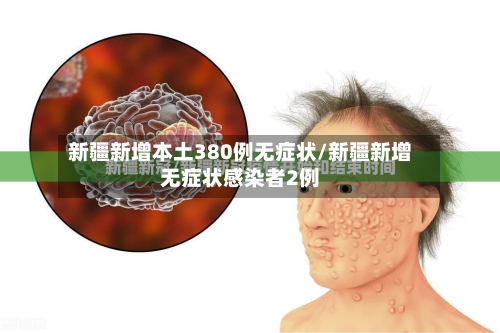 新疆新增本土380例无症状/新疆新增无症状感染者2例-第1张图片