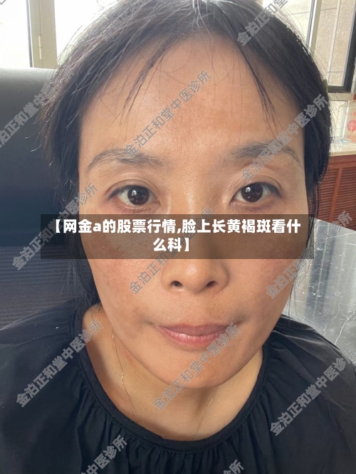 【网金a的股票行情,脸上长黄褐斑看什么科】-第2张图片